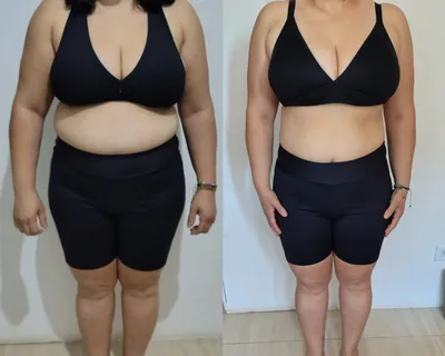 Antes e depois — aluna do Desincha 15