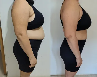Antes e depois — aluna do Desincha 15