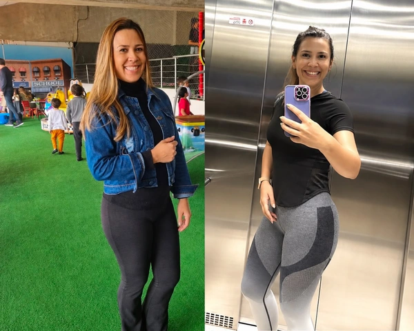 Antes e depois — Telma Oliveira