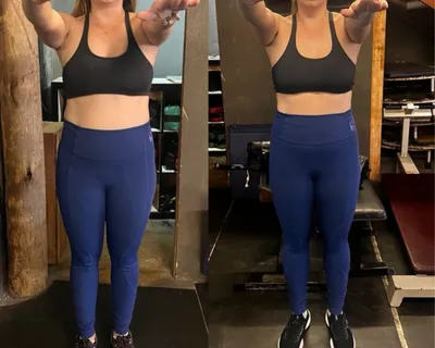Antes e depois — aluna do Desincha 15